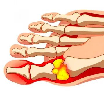 Полезная информаия о химической зависимости  Фото к статье о лечении зависимостей